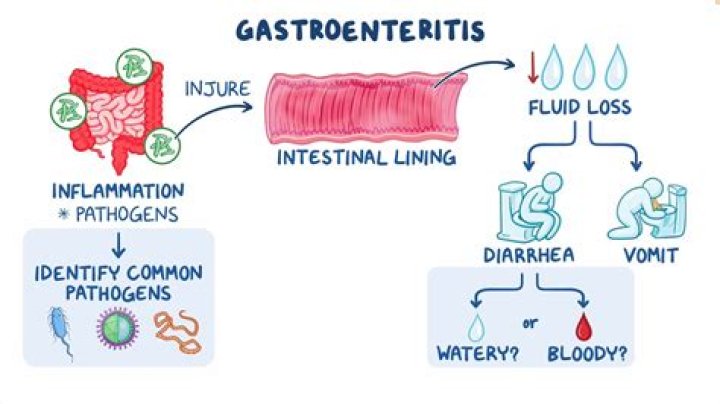 What home remedy is good for gastroenteritis?