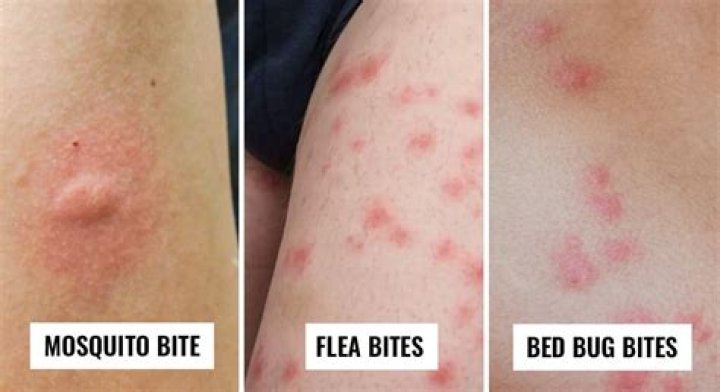 What insect is biting me under my clothes?