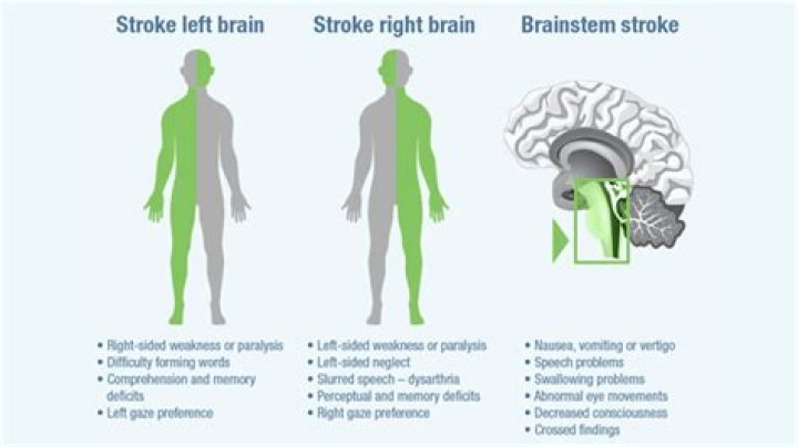 What is left brain weakness?