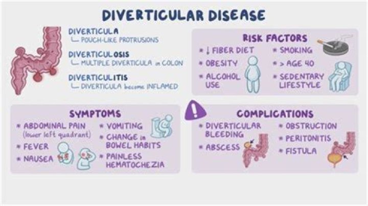 What is mild diverticular disease?