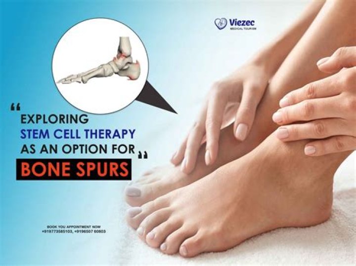 What is the best treatment for bone spurs?