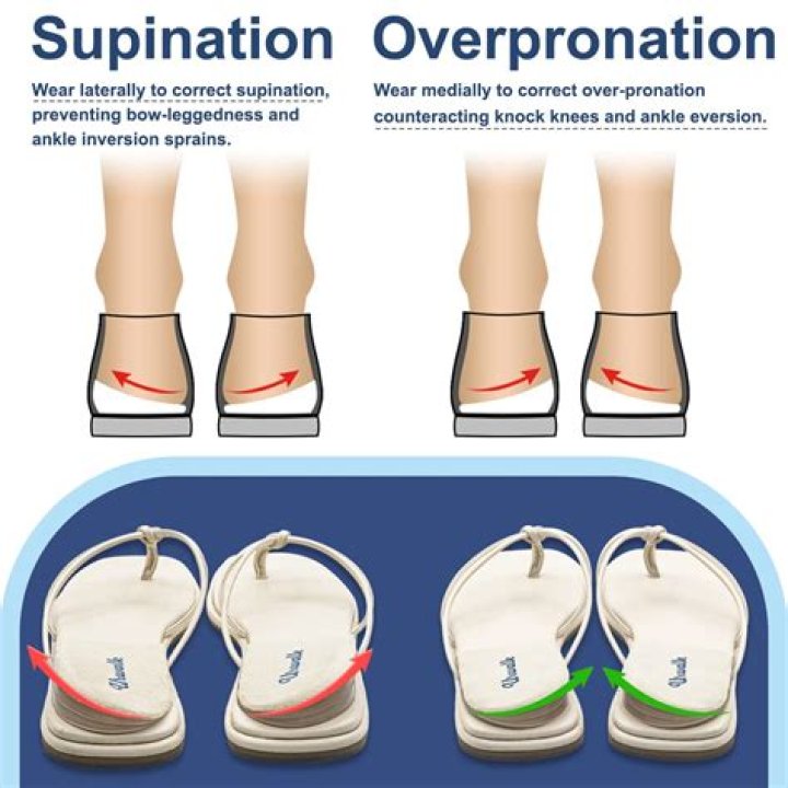 What kind of shoe do you need for supination?