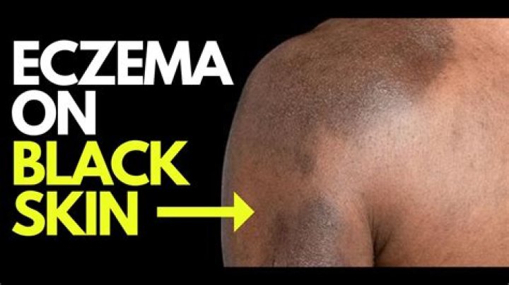 When real gold turns your skin black?