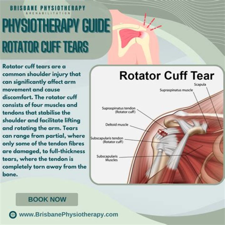 Where do you put ice on rotator cuff?