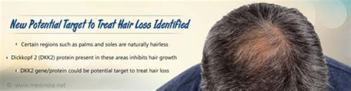 Why do humans have no hair?