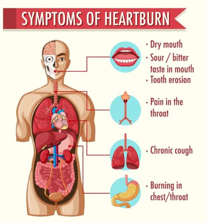Why do I get heartburn so often?