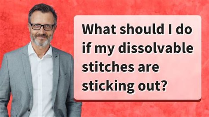 Why do my stitches feel like they are pulling?