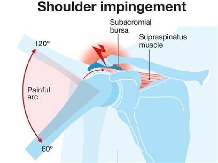 Why is it so hard to build triceps?