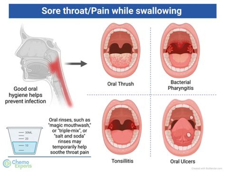 Why won't my sore throat go away?